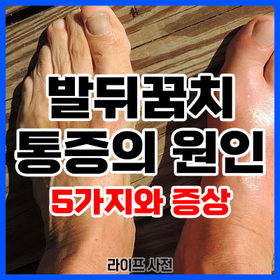 발뒤꿈치 통증의 원인