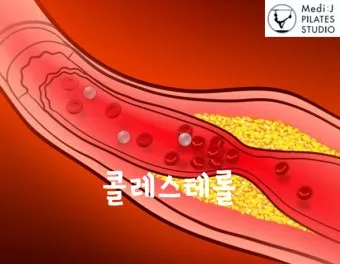 LDL 콜레스테롤 정상수치 낮추는법_4