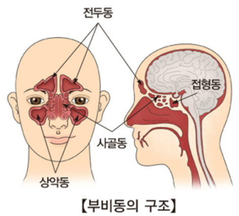 부비동염 원인