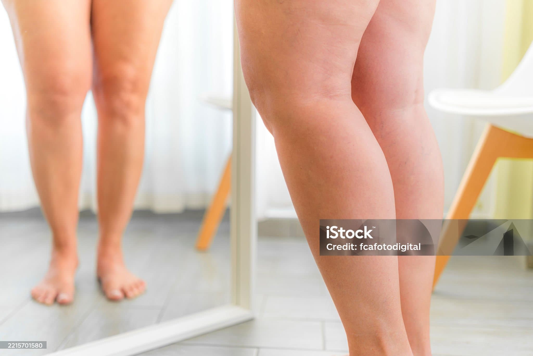 다리가 시린증상, 왜 다리만 차가울까?