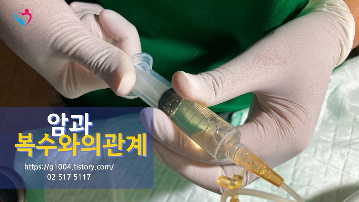 암으로 인해 복수가 생기는 원인은