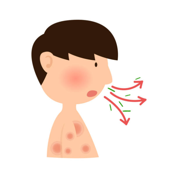 홍역 감영 경로 이미지