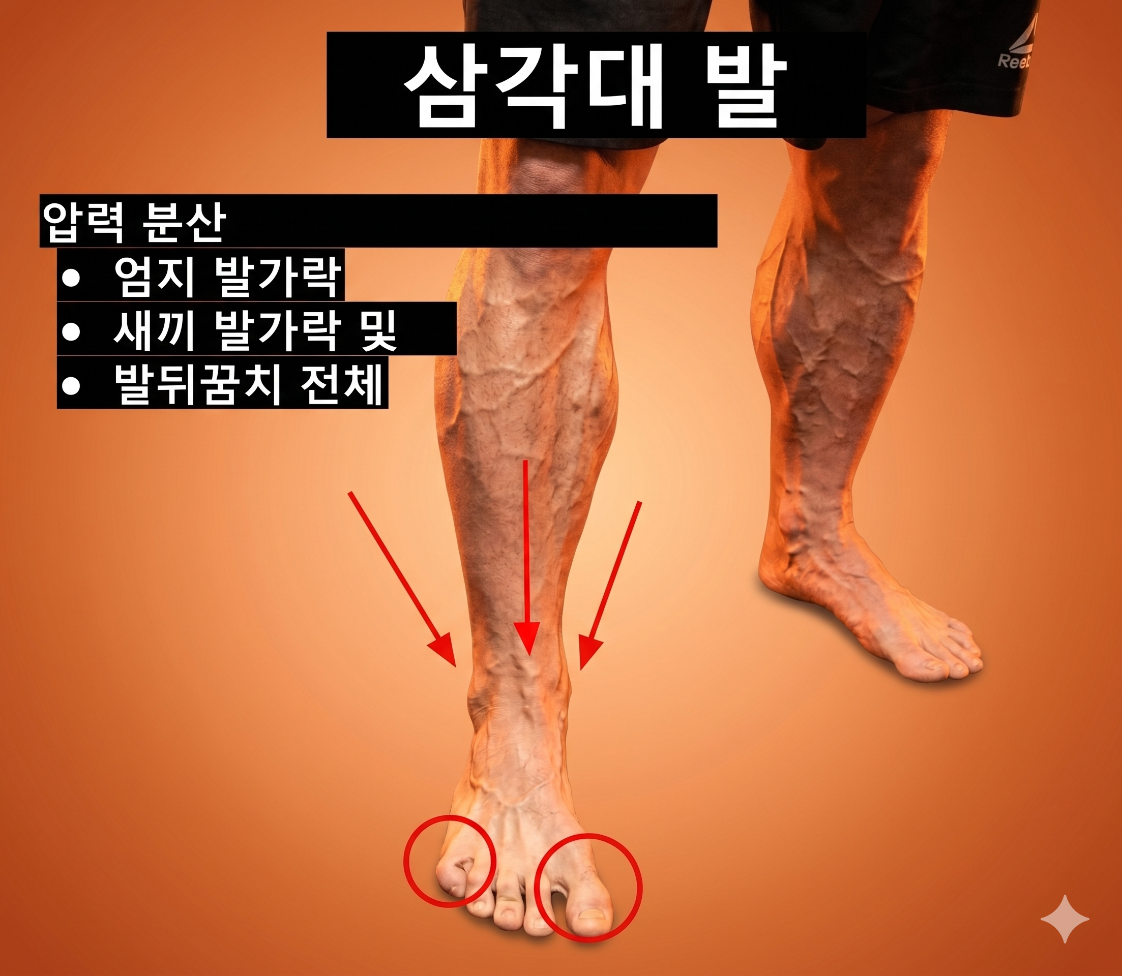 발 압력 분포