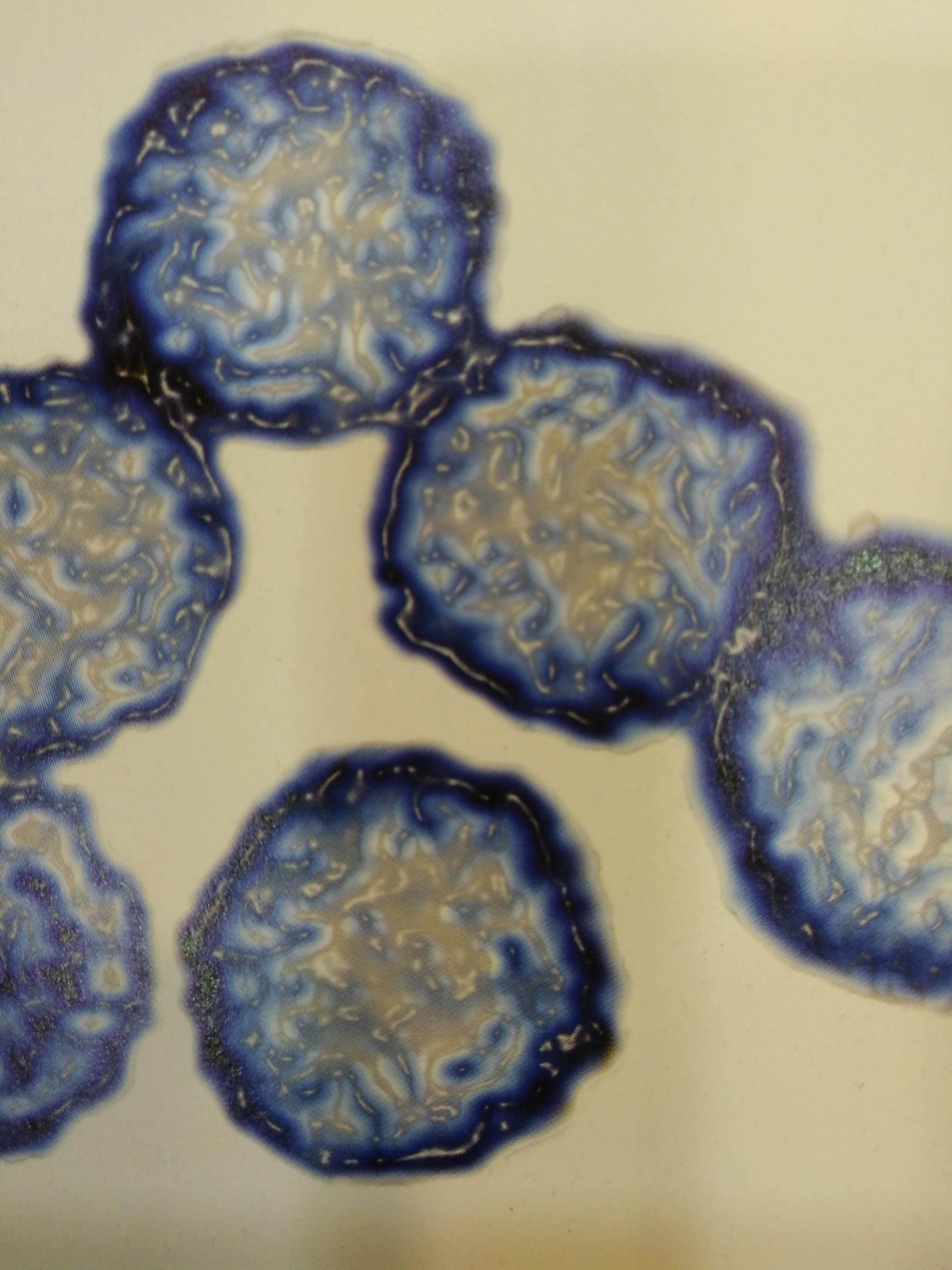 라이노 바이러스