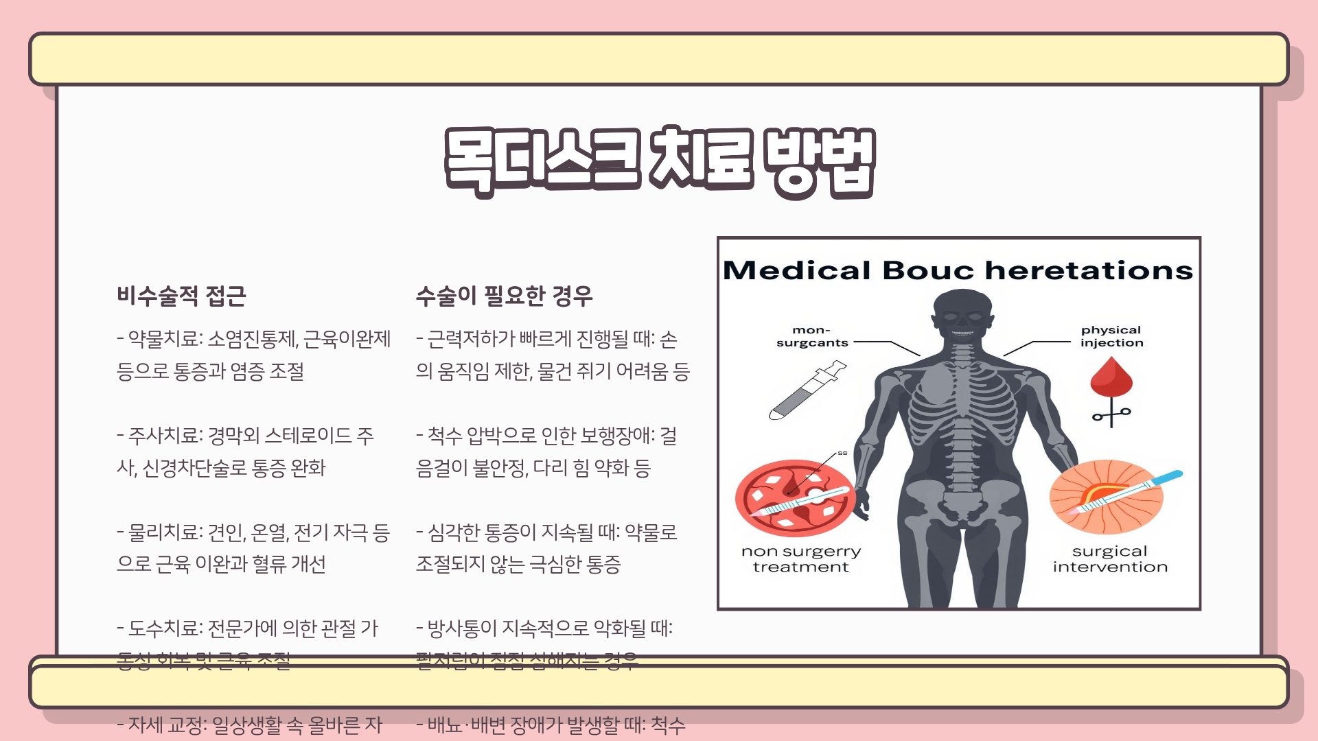 목디스크 증상 | 목디스크 팔저림 | 목디스크 두통 | 목디스크 하반신까지 이어지는 위험 신호 총정리