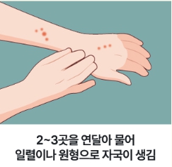 빈대 퇴치법