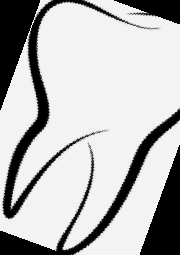 임플란트 가격 종류 비용