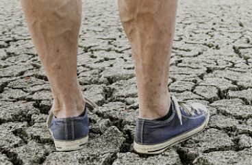 하지정맥류 증상 좋은운동 치료방법 총정리(최신)