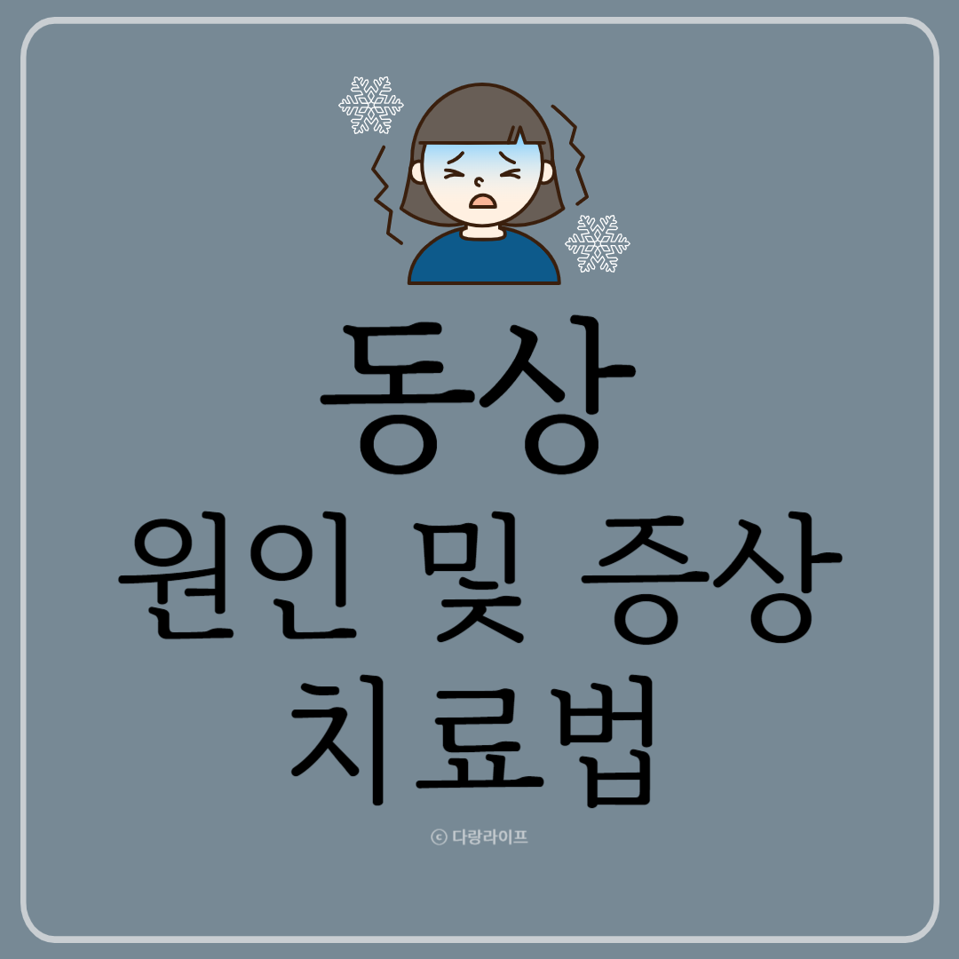 동상 원인 동상증상 동상치료법 응급처치