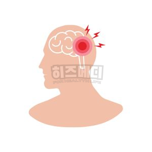 백일해 증상