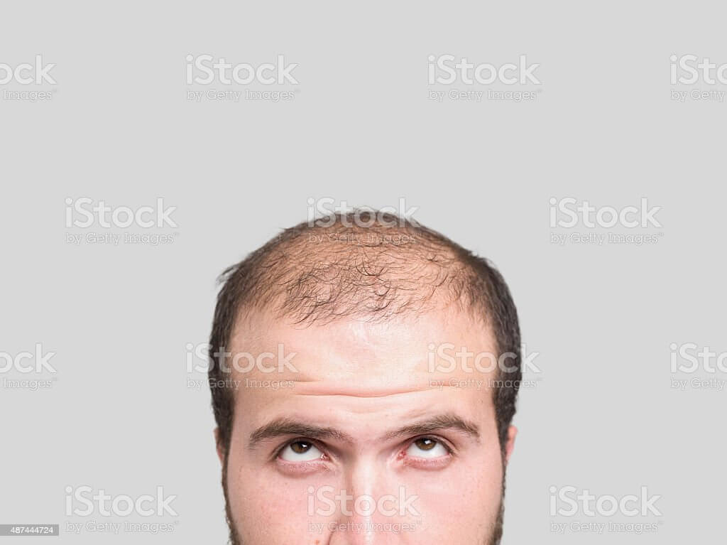 탈모 예방 방법