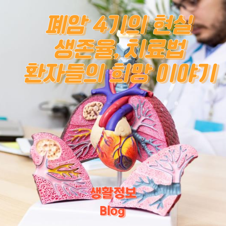 폐암 환자들의 실제 사례와 최신 연구 결과를 통해 희망과 영감을 얻으세요.