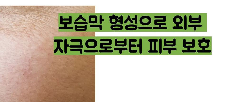 비판텐 연고 효능