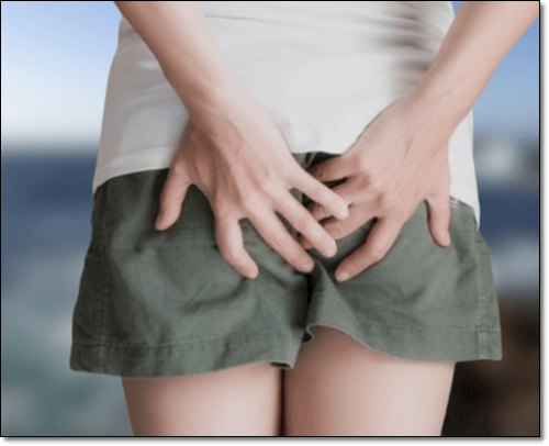 똥꼬가려움