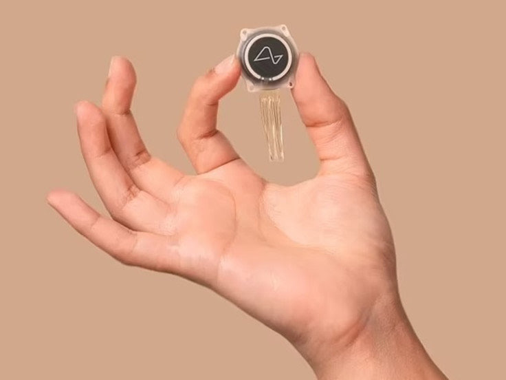 머스크의 뉴럴링크, '뇌에 칩 이식' 영국서 임상실험 시작