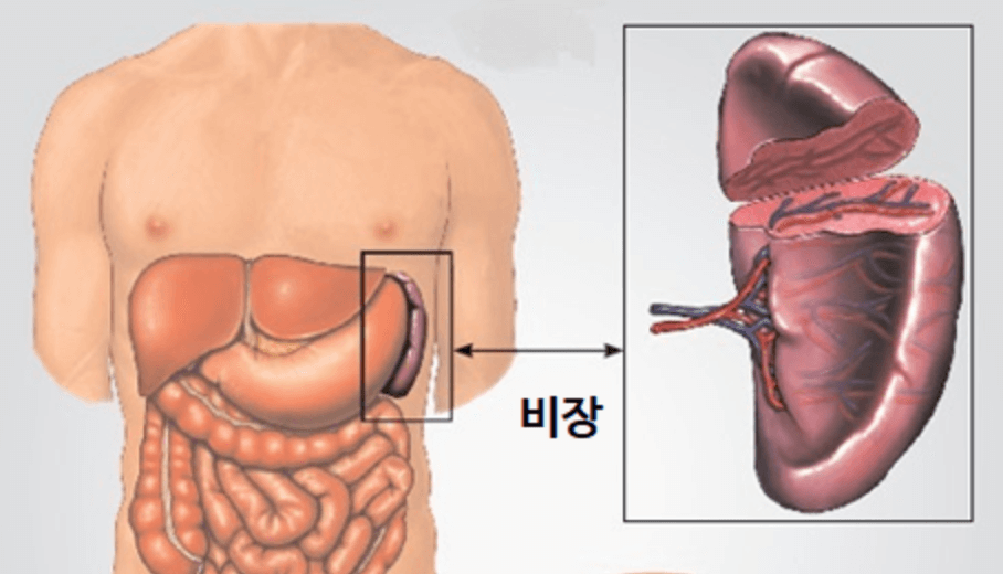 비장 장애
