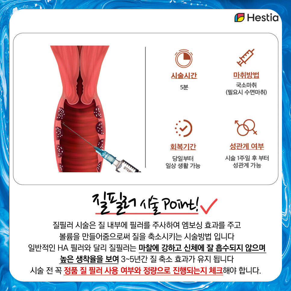 질필러