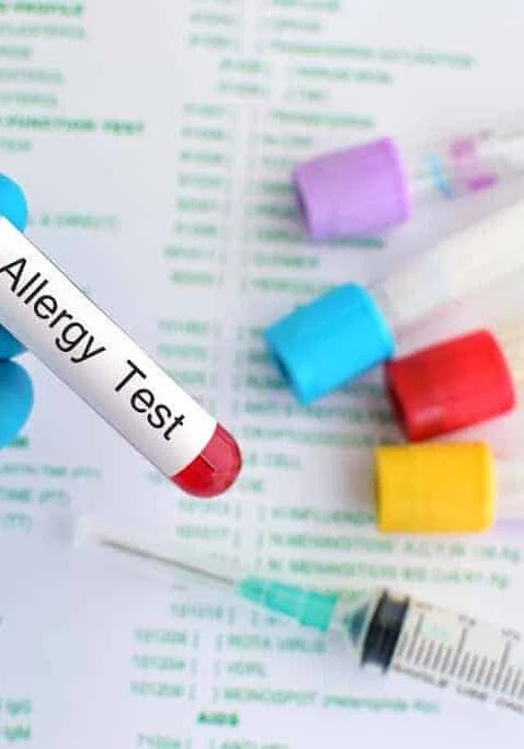 음식물 과민증 검사 원인&amp;#44; 증상&amp;#44; 검사 방법 및 식단 관리 가이드