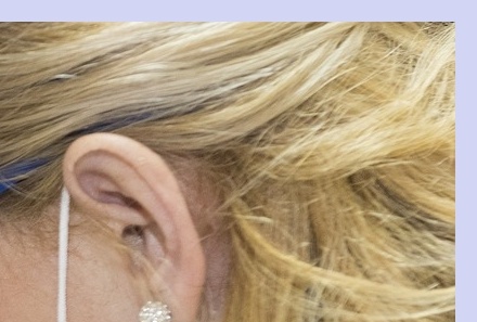 대상포진 치료기간