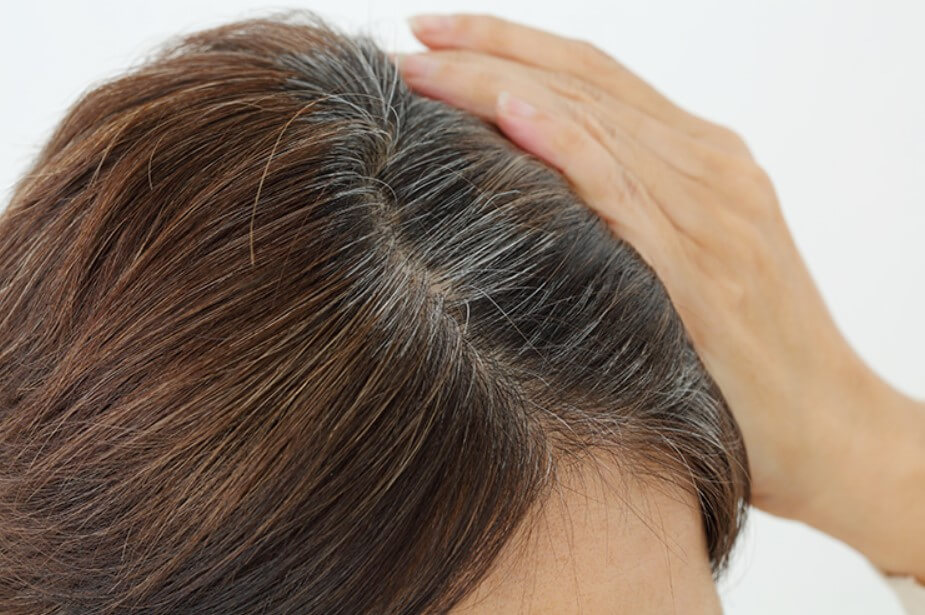 탈모 예방 혈자리