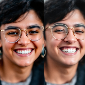 라식 vs 라섹, 실비 보험 청구 조건의 차이는?