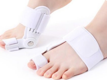 무지외반증, 여름철 신발이 발 건강에 미치는 영향 관련 이미지