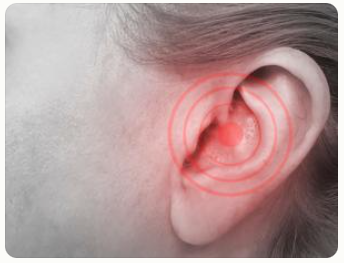 이명 증상 원인 치료방법