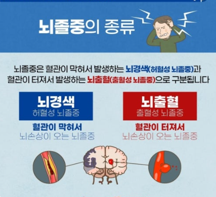 허혈성 뇌졸중 과 출혈성 뇌졸중 관련 사진
