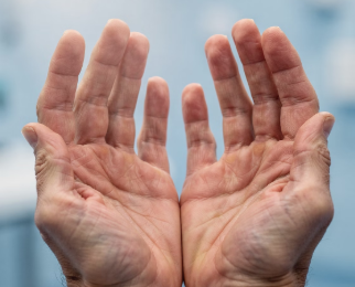 파킨슨병 초기증상