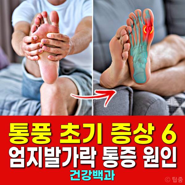 통풍 초기증상 엄지발가락 통증 원인 통풍 증상