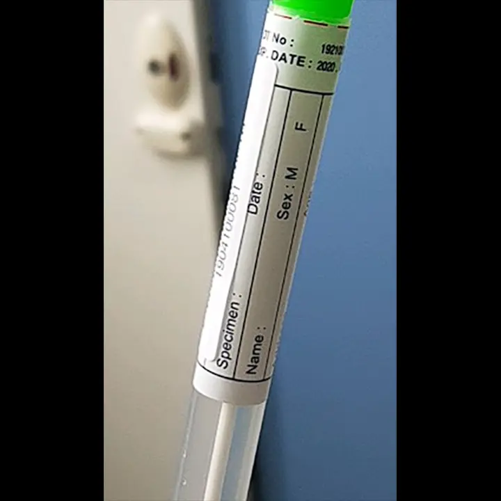 보건증 항문검사 필수인가요