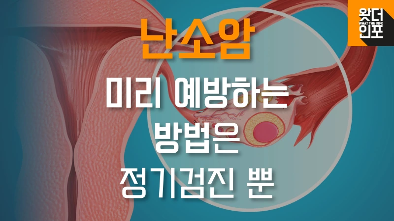 난소암 예방하는 방법 썸네일 이미지