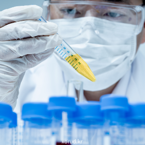 조기 발병 대장암