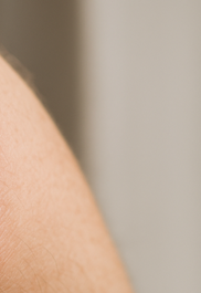 건선 피부염 완전정리