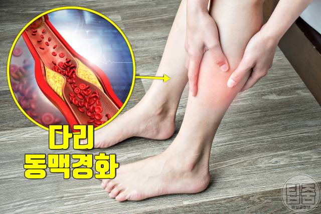 좋은 콜레스테롤 높이는 방법 콜레스테롤 정상 만들기
