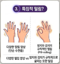 파킨슨병 초기증상