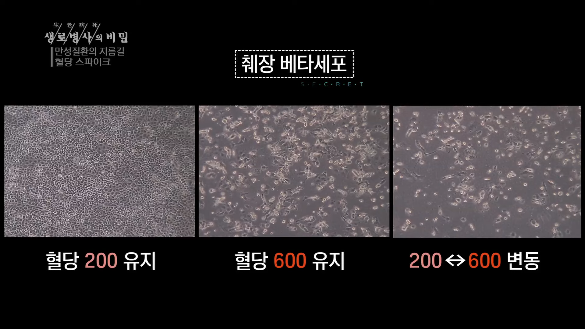 생로병사의 비밀 만성질환의 비밀 혈당 스파이크 당뇨병