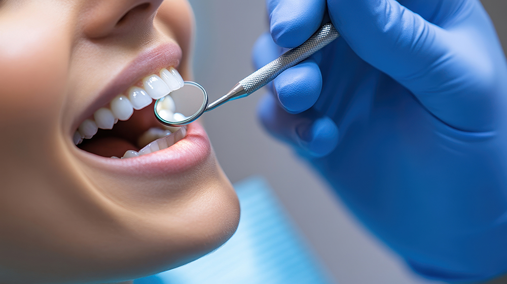 무삭제 라미네이트 가격