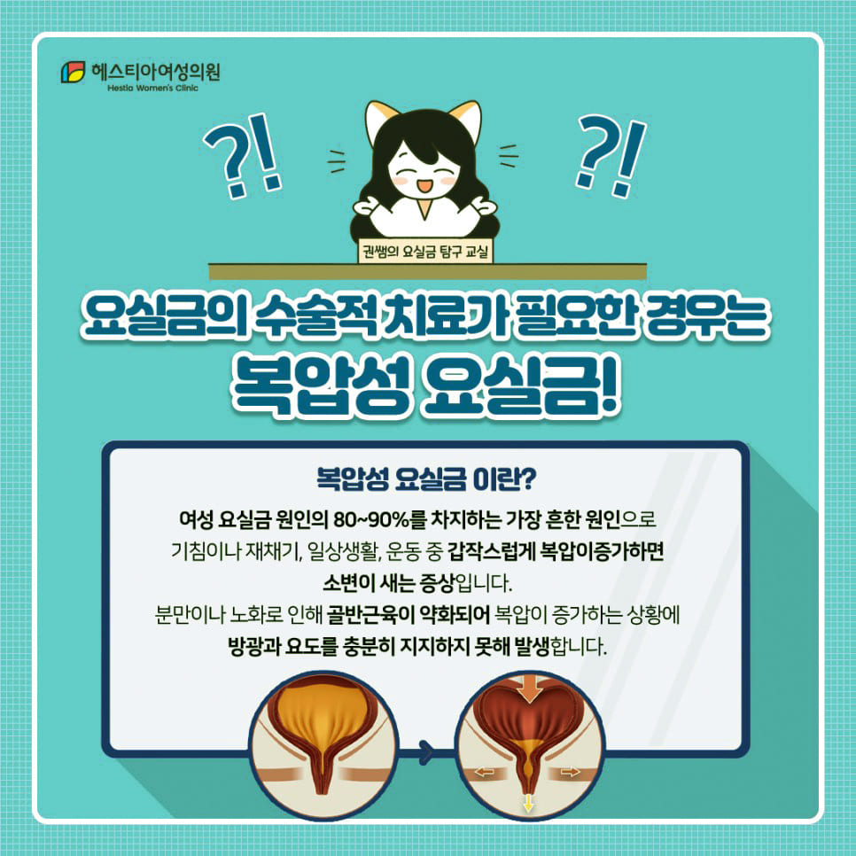 요실금치료 수술이 필요한 복압성 요실금