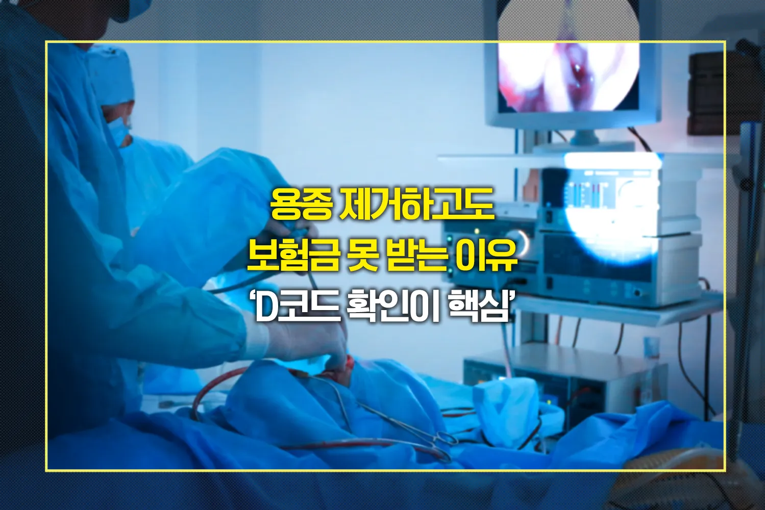 내시경-용종제거-보험금