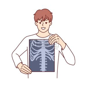 마이코플라스마 폐렴 전염 증상