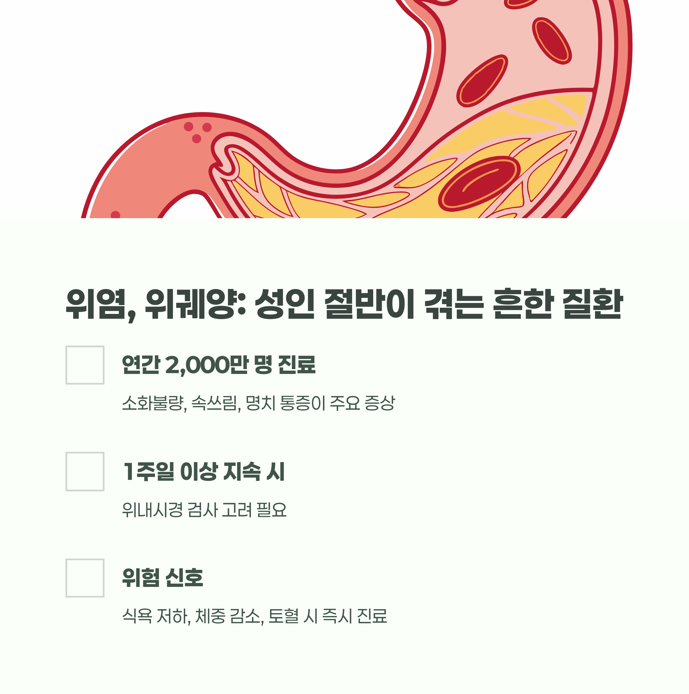 위염, 위궤양은 국내 성인 중 절반 이상이 겪는 흔한 질환입니다