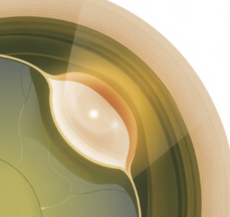 눈에 날파리 현상