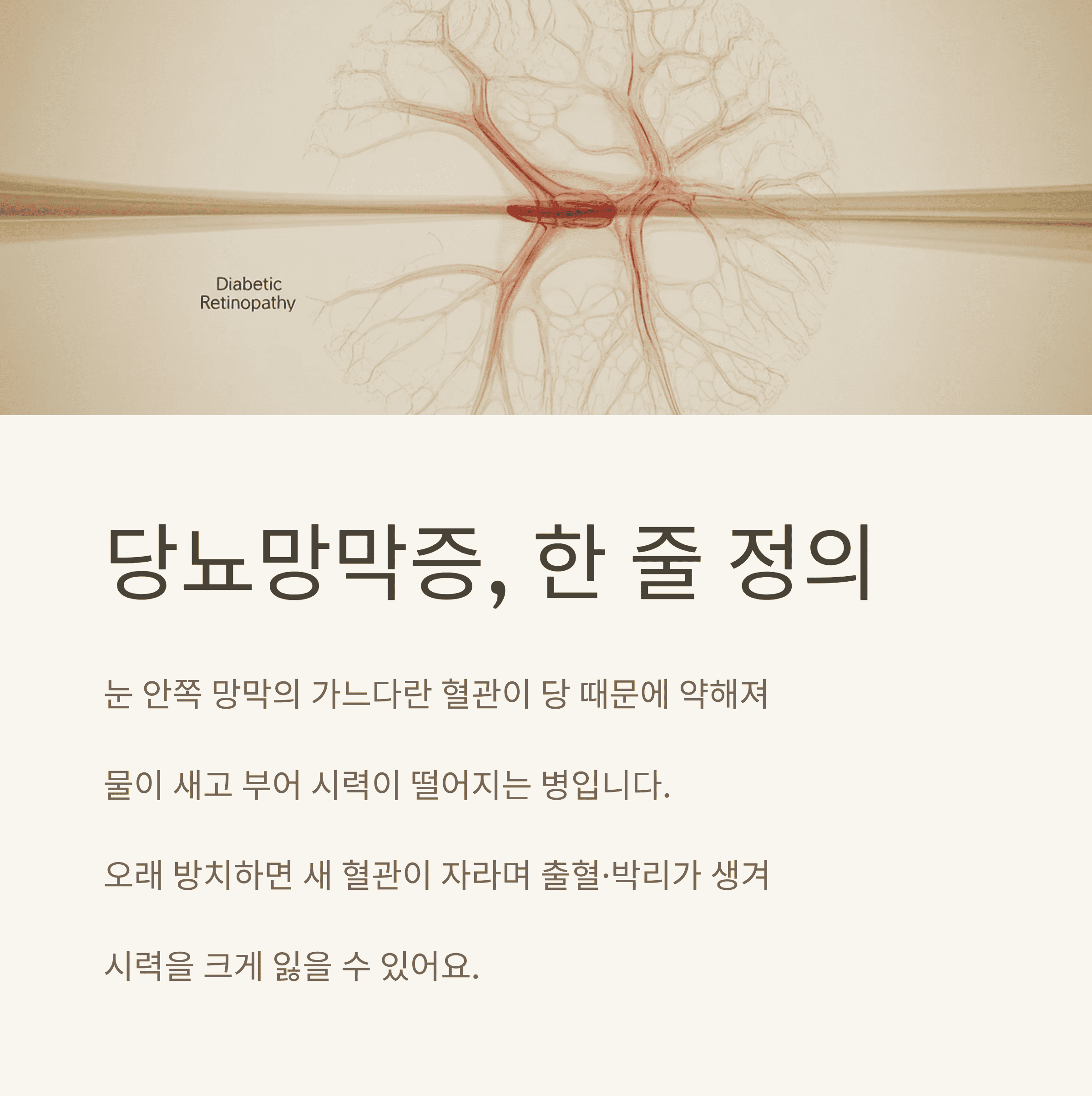 당뇨 망막증 8주 전략으로 막아보자