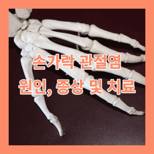 손가락 관절염 원인, 증상 및 치료