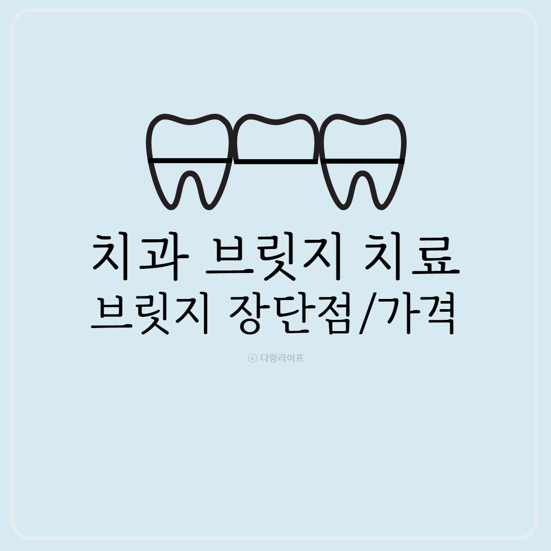 치과브릿지 치료 브릿지장단점 브릿지가격