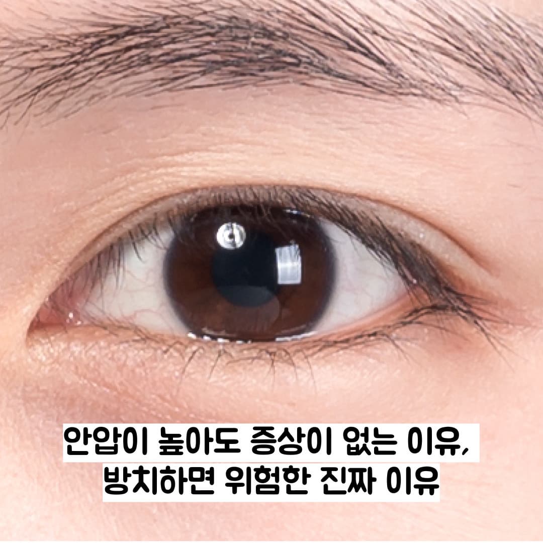 안압이 높아도 증상이 없는 이유, 방치하면 위험한 진짜 이유