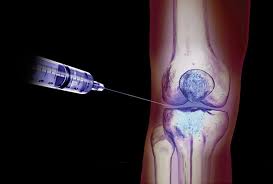 2025년 최신 무릎 연골 주사 종류 비교