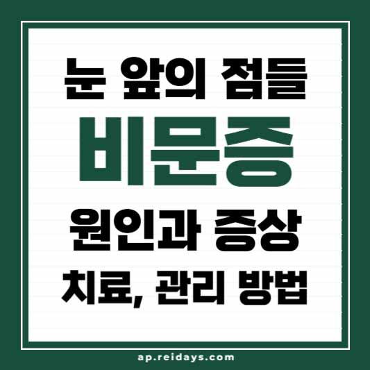 비문증 원인과 증상, 치료, 관리 방법