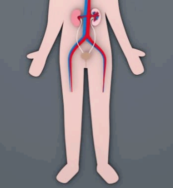 소변이 자주 마려운 증상&amp;#44; 이유와 자가치료법&amp;#44; 병원은 언제?
